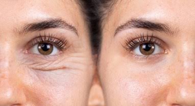 Pesquisadores analisando células em processo de reversão do envelhecimento